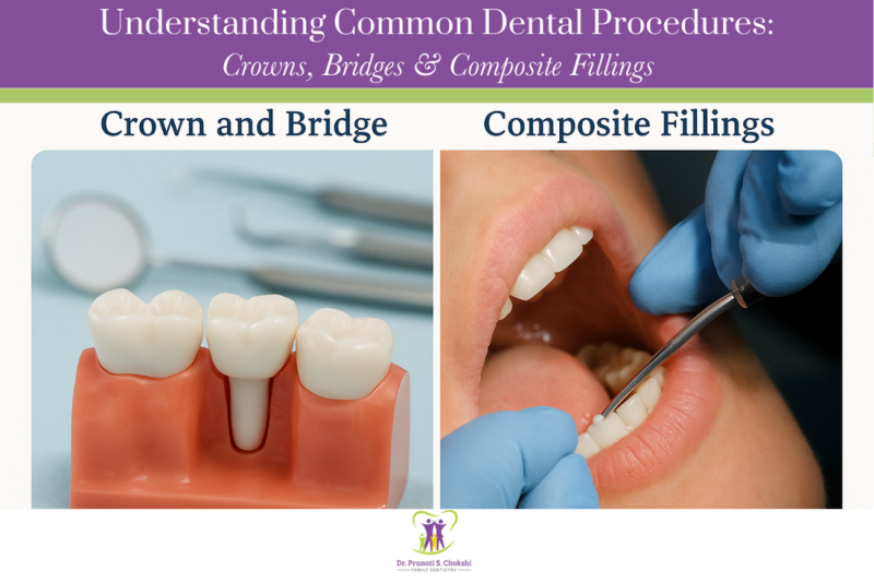 Understanding Common Dental Procedures Crowns, Bridges& Composite Fillings