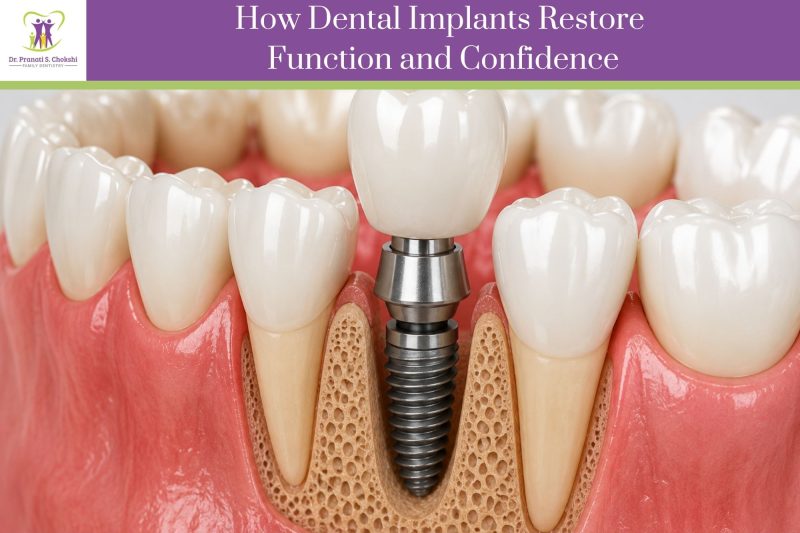 How Dental Implants Restore Function and Confidence | Winter Garden Family and Cosmetic Dentist