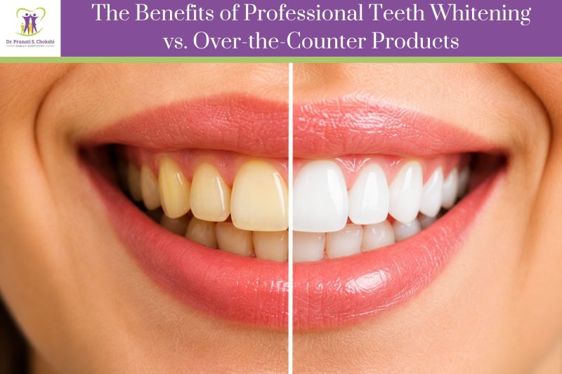The Benefits of Professional Teeth Whitening