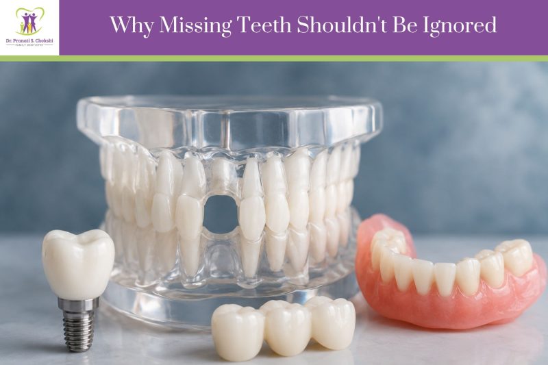 Why Missing Teeth Shouldn't Be Ignored | Winter Garden Family and Cosmetic Dentist